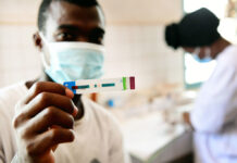 Les personnes séropositives confrontées au double danger du VIH et de la Covid-19