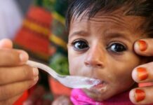 Une explosion catastrophique des taux de malnutrition sévère chez les enfants menace le monde, selon l’UNICEF